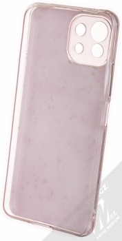 1Mcz Gold Glam Růžové odlesky Skinny TPU ochranný kryt pro Xiaomi Mi 11 Lite, Mi 11 Lite 5G růžová (pink) zepředu